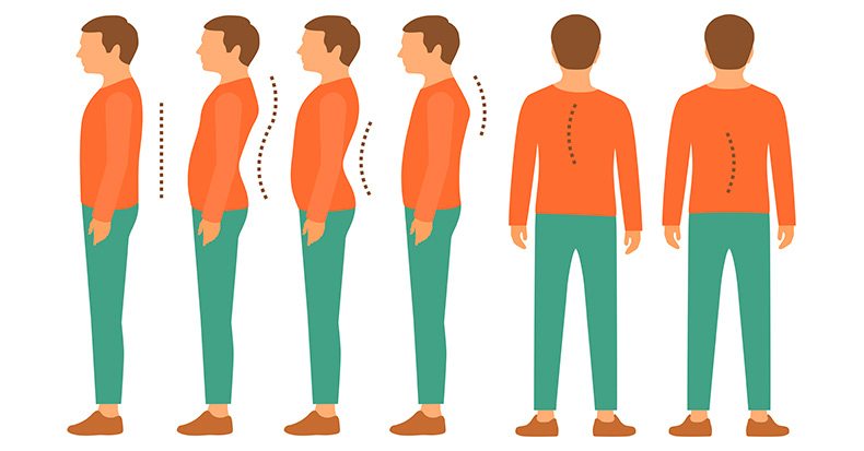 posture diagram