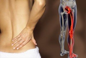 sciatic