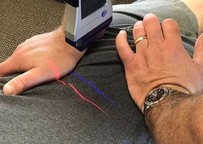 cold laser therapy at warwick chiropractic