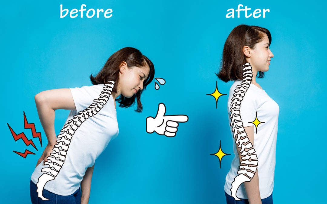 Improve posture with exercise
