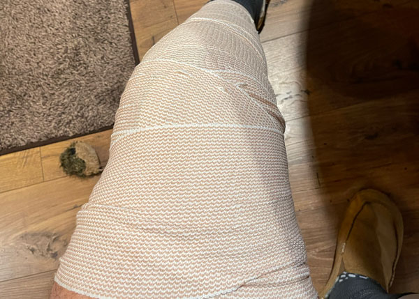 chiropractic-care-post-knee-surgery